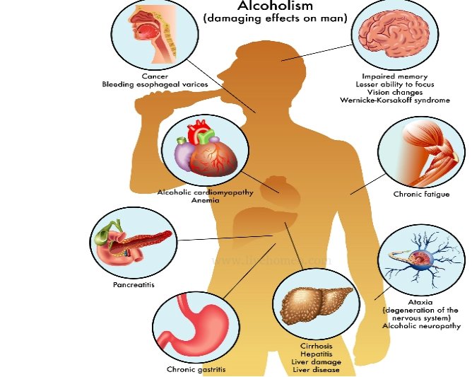 Drinking is injurious to health.
Say no to Alcohol 🚫⛔️
#QuitAlcoholHabits 
#alcoholawareness