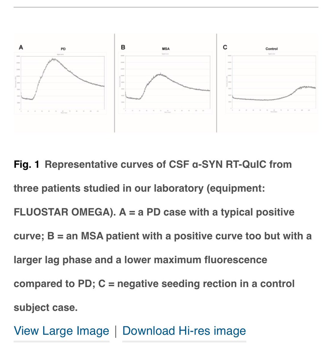 #Highlights #XXVIII #IAPRD #WorldCongress #ParkinsonDisease #PD #Chicago #review #fluid #biomarker #seedamplification #SAA

Fluid and tissue biomarkers in Parkinson’s disease: Immunodetection or seed amplification? Central or peripheral?
@PRDAssociation 

prd-journal.com/article/S1353-…