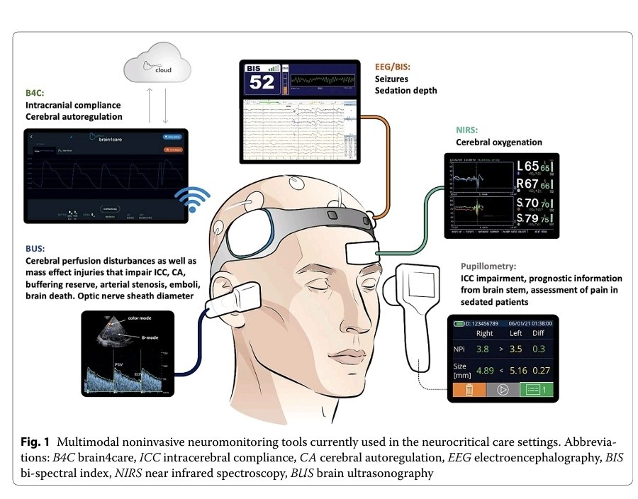 LeslieMegom's tweet photo. 💥🧠Neuromonitorización no invasiva en pacientes👥️ con lesión cerebral aguda🤯
👇🏽👇🏽👇🏽👇🏽👇🏽👇🏽
https://t.co/iKekrj92m0…
🗝🔓
https://t.co/KHLhox8MGp…
@chiara_robba https://t.co/upyMdFkS77