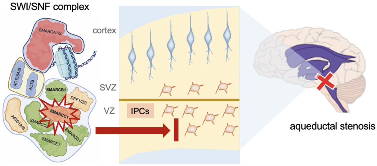 Hydrocephalus is the most common disease requiring neurosurgery in children. Singh et al. show an association between mutations in the chromatin remodelling gene SMARCC1 and congenital hydrocephalus with a variety of syndromic features. tinyurl.com/3rxbrb72