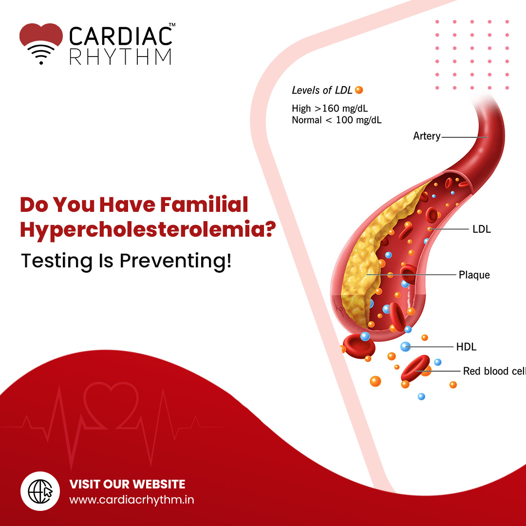 CardiacRhythmIN's tweet photo. We offer testing for FH diagnostic services to help you get to the bottom of familial hypercholesterolemia and other heart issues. Contact us today.
#FamilialHypercholesterolemia #CholesterolTesting #HealthcareServices #HeartHealth #CardiacRhythm https://t.co/eUkTcvyeNi