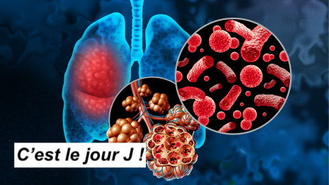 La_SRLF's tweet photo. Plongez au cœur du débat médical : quelle stratégie adopter pour les pneumonies communautaires sévères en 2024 ?
Rendez-vous ce jour, le jeudi 18 avril, à 16h00. 
Participer au webinar : https://t.co/zkqWMnZ8n3 
#SRLF #CCOF https://t.co/vTPOZdQjZZ