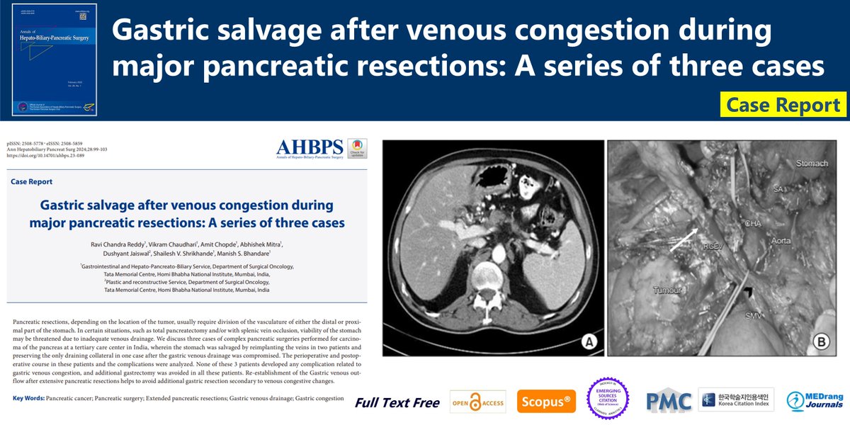 Gastric salvage after venous congestion during major pancreatic resections: A series of three cases 🌷doi.org/10.14701/ahbps… 2024 Feb;28(1)Ravi Chandra Reddy #Pancreatic_cancer #Pancreatic_surgery #Extended_pancreatic_resections #Gastric_venous_drainage #Gastric_congestion