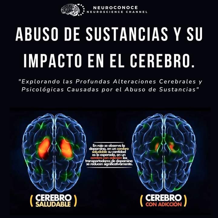 RebolledaGil's tweet photo. Cómo influye el abuso de sustancias estupefacientes en el cerebro??? 👇👇👇👇👇 https://t.co/gW7vVIoNxp