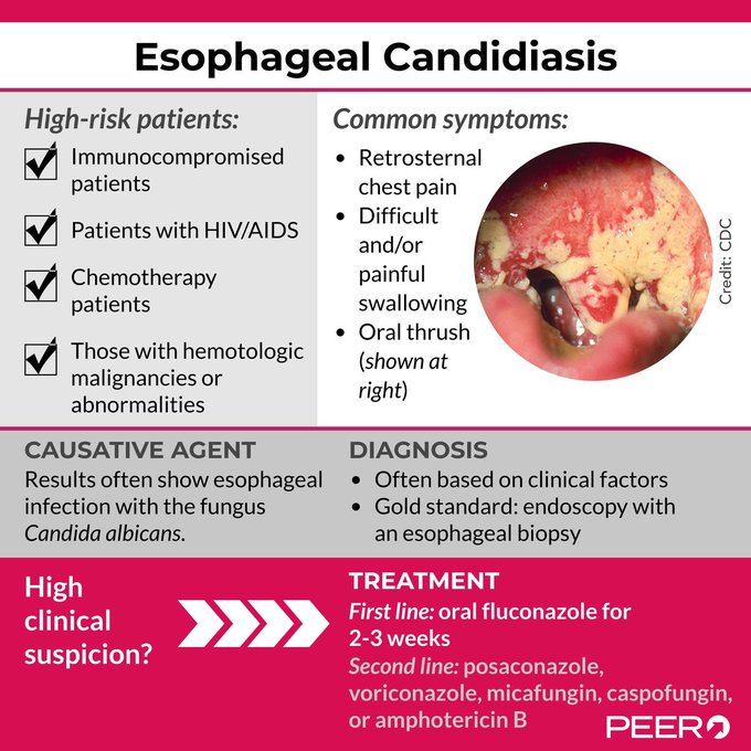 @drkeithsiau Impressive! 

Is your patient with grade 4 esophageal candidiasis  immunocompromised ?

<image source: @ACEPNow, tinyurl.com/5n83y4ve>