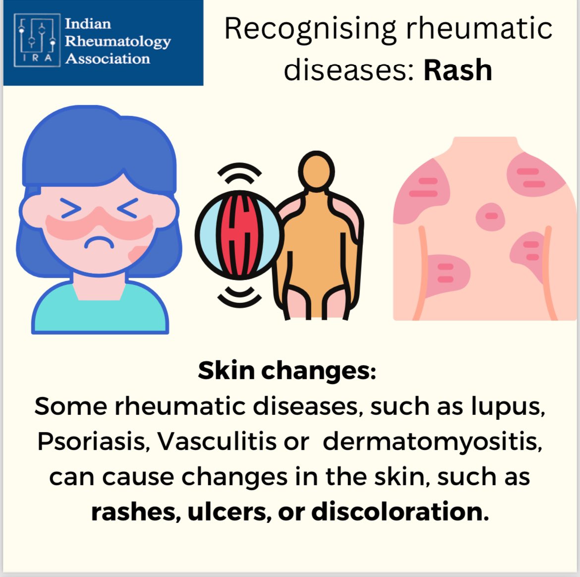 Skin is one of the common organ involved in rheumatic diseases either as a presenting symptoms or during the course of illness 

#awareness #IRA #Rheumatology #autoimmune #Disease #Treatable #diagnosis 

IRA is observing April as #Awareness month for Autoimmune Diseases