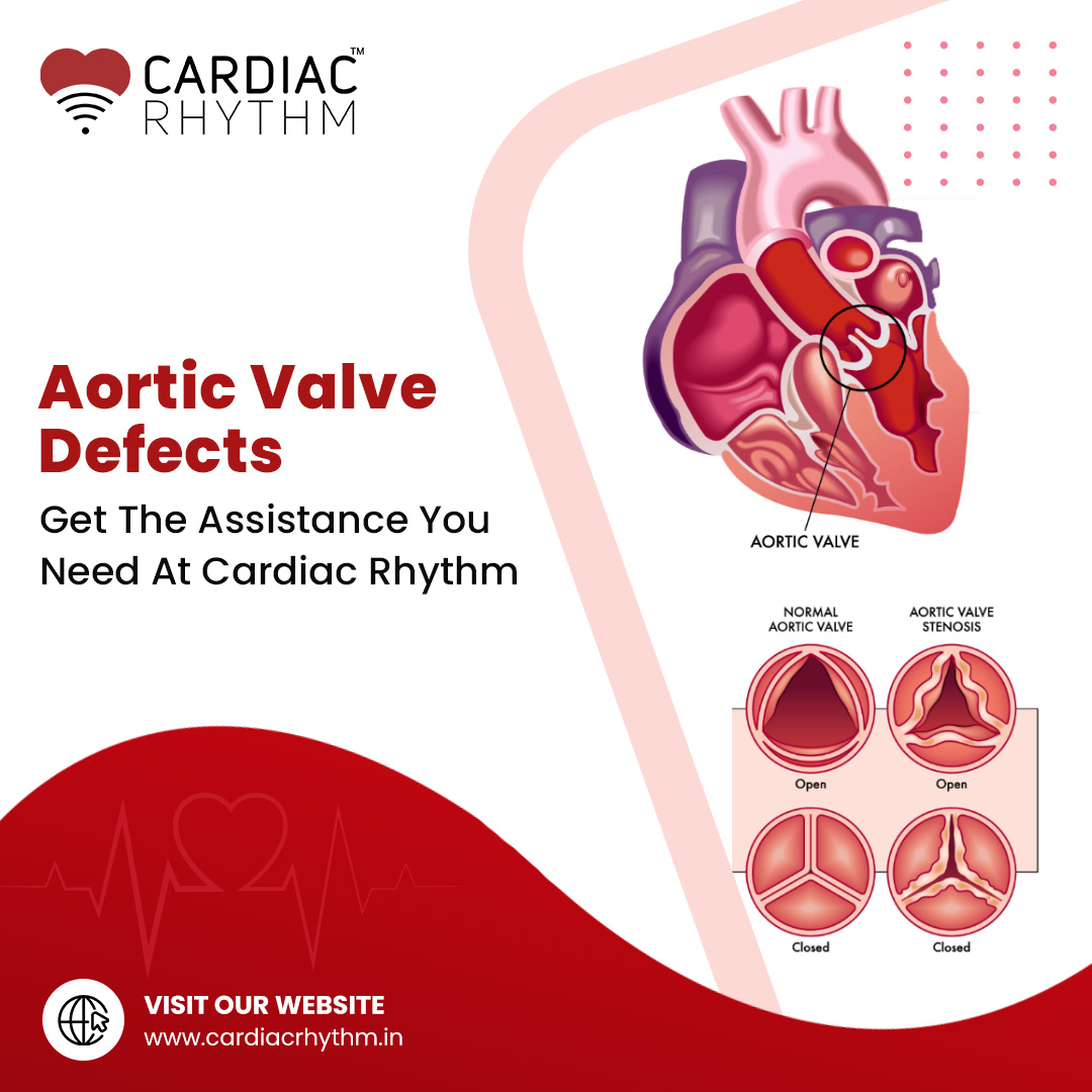 CardiacRhythmIN's tweet photo. If you require aortic valve issue detection services to help you restore proper cardiovascular function &amp; prevent heart failure, contact us today.
#CardiovascularHealth #HeartHealth #MedicalTesting #HeartFailurePrevention #CardiacRhythm https://t.co/sNQBuQcmTG