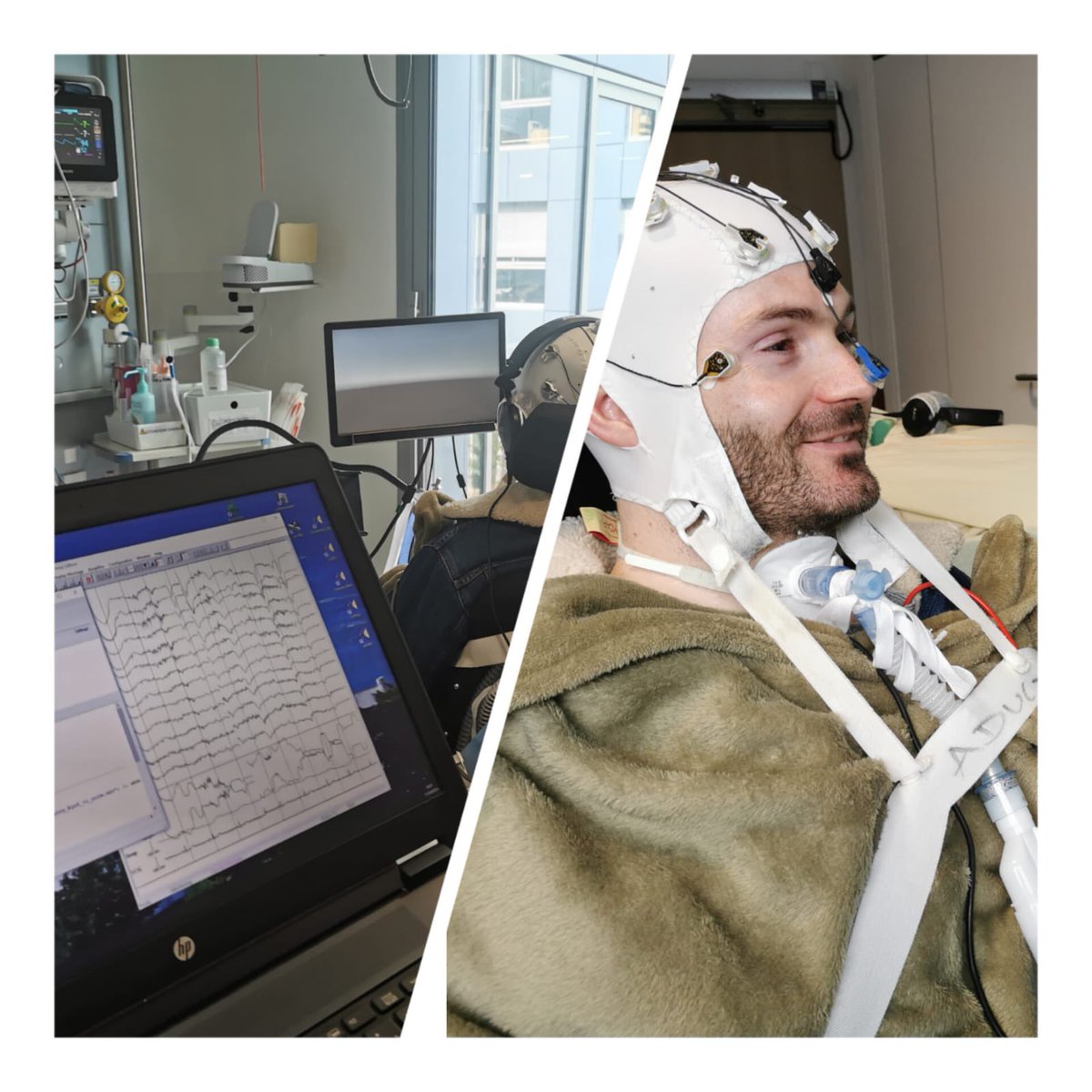 MPR Neurologique Nantes (@mprnantes) on Twitter photo Début des inclusions de <a href="/MprNantes/">MPR Neurologique Nantes</a> dans la recherche multicentrique #cophy équipe Trajectoire CRNL Lyon : évaluation EEG du contrôle de l’attention chez des patients avec handicap moteur sévère. Début des inclusions de <a href="/MprNantes/">MPR Neurologique Nantes</a> dans la recherche multicentrique #cophy équipe Trajectoire CRNL Lyon : évaluation EEG du contrôle de l’attention chez des patients avec handicap moteur sévère.