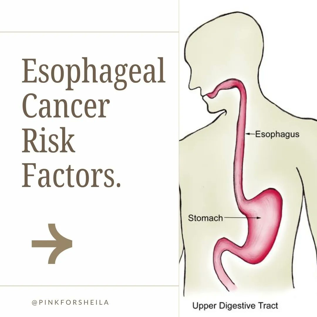 🔍 Understanding the risk factors for esophageal cancer can help you take proactive steps to protect your health. From tobacco and alcohol use to chronic acid reflux, knowing the facts can make all the difference. #ProtectYourHealth #KnowTheRisk #EsophagealCancerAwareness