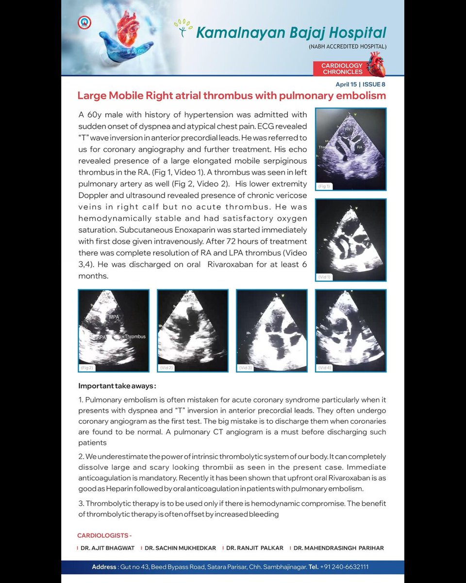 Thrilled to share a breakthrough at Kamalnayan Bajaj Hospital's Cardiology Chronicles!

Witness the success of “Large mobile right atrial thrombus with pulmonary embolism”

#KamalnayanBajajHospital #cardiac #centerofexcellence #cardiology  #healthcareinnovation #hearthealth