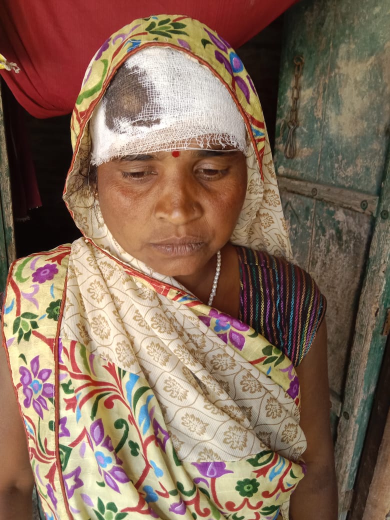 anandra10059713's tweet photo. @sitapurpolice @Uppolice @112UttarPradesh @aajtak @AmarUjalaNews @myogioffice @PRESIDENTIHRPO @LavishV65623537 @AnkitSir19 श्रीमान पुलिस ��धीक्षक महोदय सीतापुर उक्त प्रकरण को संज्ञान में लेते हुए तत्काल कार्यवाही करवाने की कृपा करें। महिला को गंभीर चोटें आई हुई हैं। https://t.co/xhD0AsoQZ7