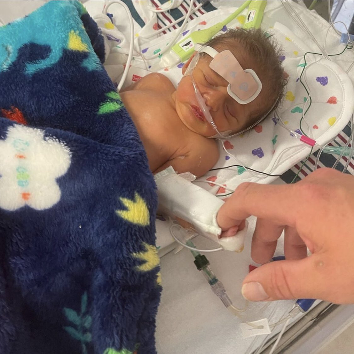 He really appreciated the ketamine drip! We will talk during rounds in the morning about the formal reading of her diaphragm and go from there. The informal reading though says he has movement in the right but not so much in the left. We also talked today about it