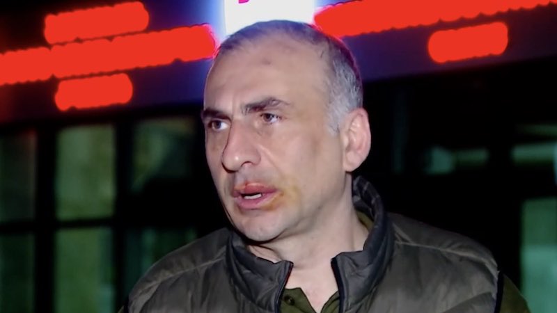 🇬🇪MP Aleko Elisashvili, who recently punched Mdinaradze, alleges police beat him during an April 17 #NoToRussianLaw rally at @GovernmentGeo, claiming it was on the head of patrol police's orders. He later discovered a broken rib at the clinic.