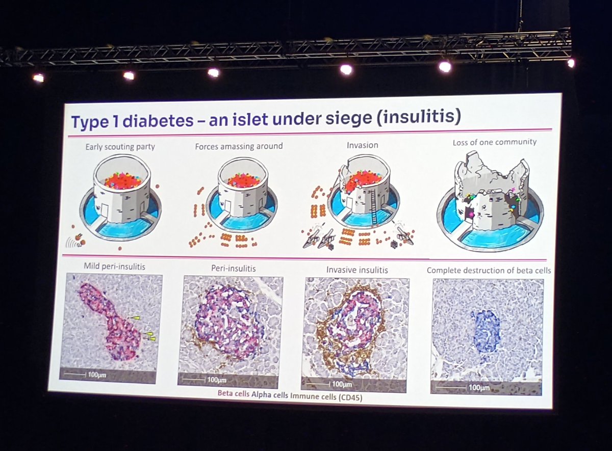 Great graphic from #DUKPC2024 conference, at yesterday's session about the #grandchallenge. Showing how Beta Cells are destroyed by the immune system. #dedoc
