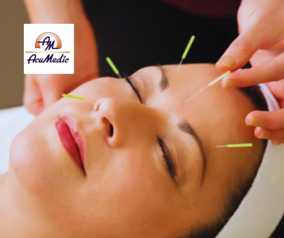 AcuMedic_Pro's tweet image. NEW COURSE DATE:

Cosmetic Acupuncture (Level 5) at AcuMedic Professional will now take place on
22-24 Nov.

One of the most comprehensive courses in the world, with unique techniques designed and clinically tested.

Learn more and book your spot today:

shop.acumedic.com/product/amf-ca…