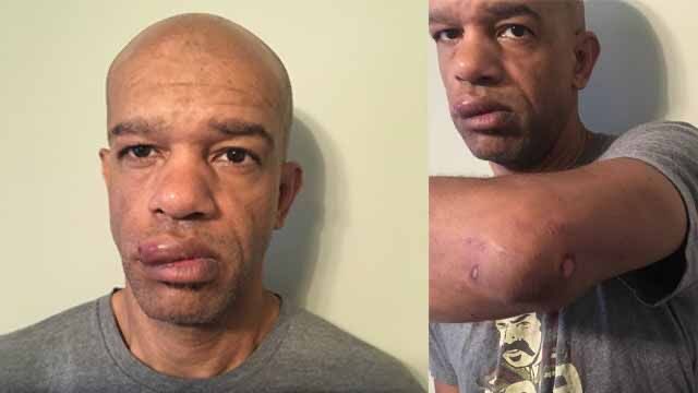 Remember Luther Hall, an ex-officer from the St. Louis police department? He was recently granted an award of nearly $23.5M after being assaulted by his fellow officers while undercover at a protest. Hall recalls that during the 2017 protest - sparked by the dismissal of another