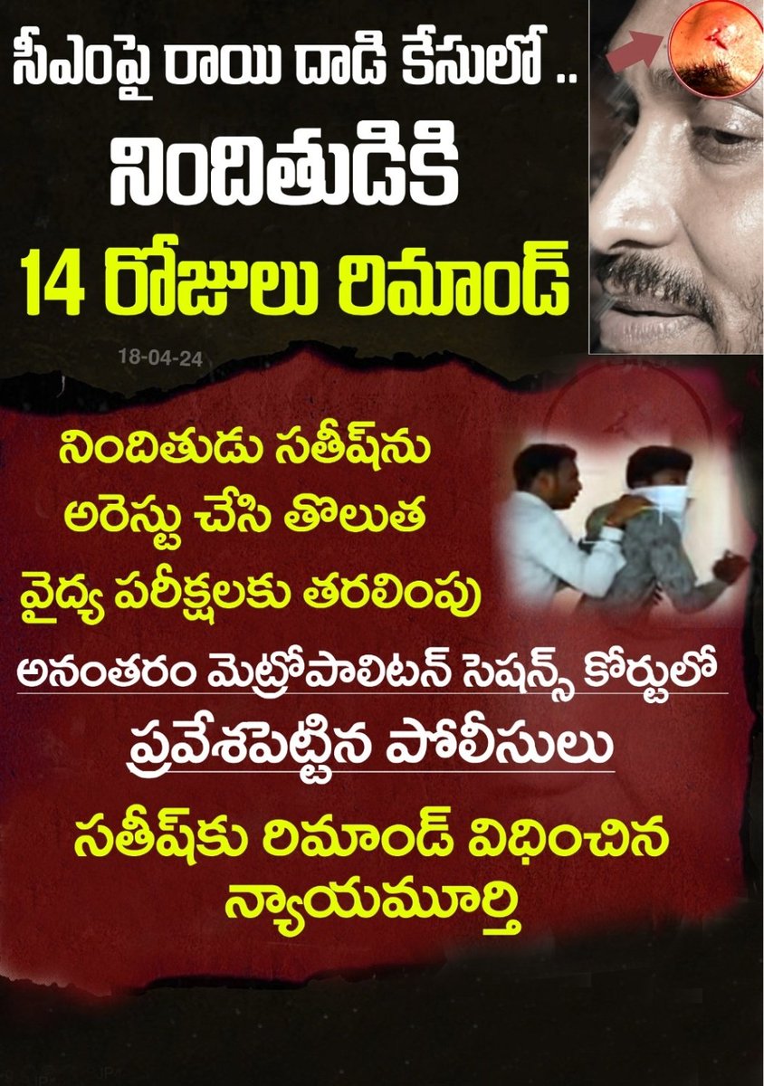 In the case of stone attack on CM Jagan.
Accused remanded for 1
@MemuSiddham
@SRIDHAR_YSRCP
@YSRCParty 
@ysjagan 
#vijayawada
@JaiTDP 
@JanaSenaParty
@BjpPARTY 
@Congresspartyy 
@eenadulivenews 
@abntelugutv 
@tv5newsnow 
@JaganannaCNCTS 
@JaganannaOnceMore