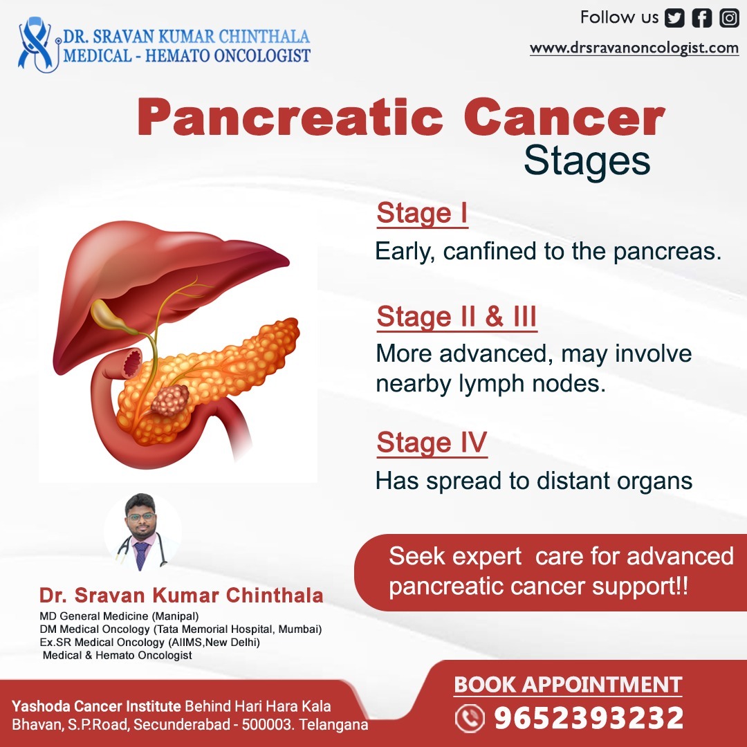 Learn more about stages of #PancreaticCancer .

#DrSravanKumar #BestOncologist #Hematologist #Oncologist #YashodaHospital #Secunderabad #Hyderabad #Cancer #CancerSpecialist #Cancerhospital #CancerDoctor #Cancertreatment #cancerprevention #Cancercare #chemotherapy #immunotherapy