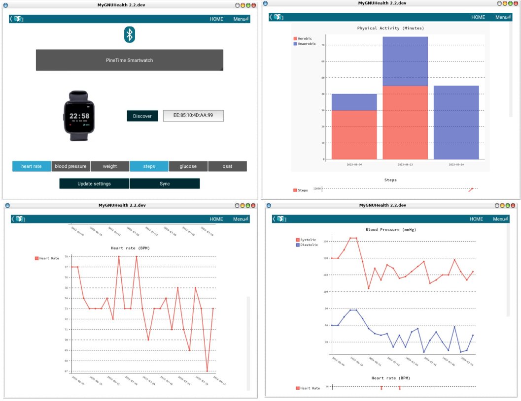 The upcoming #MyGNUHealth 2.2 allows to pair and sync data from #bluetooth  medical devices such as glucometers, blood pressure monitors and  smartwatches like the #PineTime from @thepine64 . Stay tuned! 😎🩺
#GNU #OpenScience #eHealth #GNUHealth