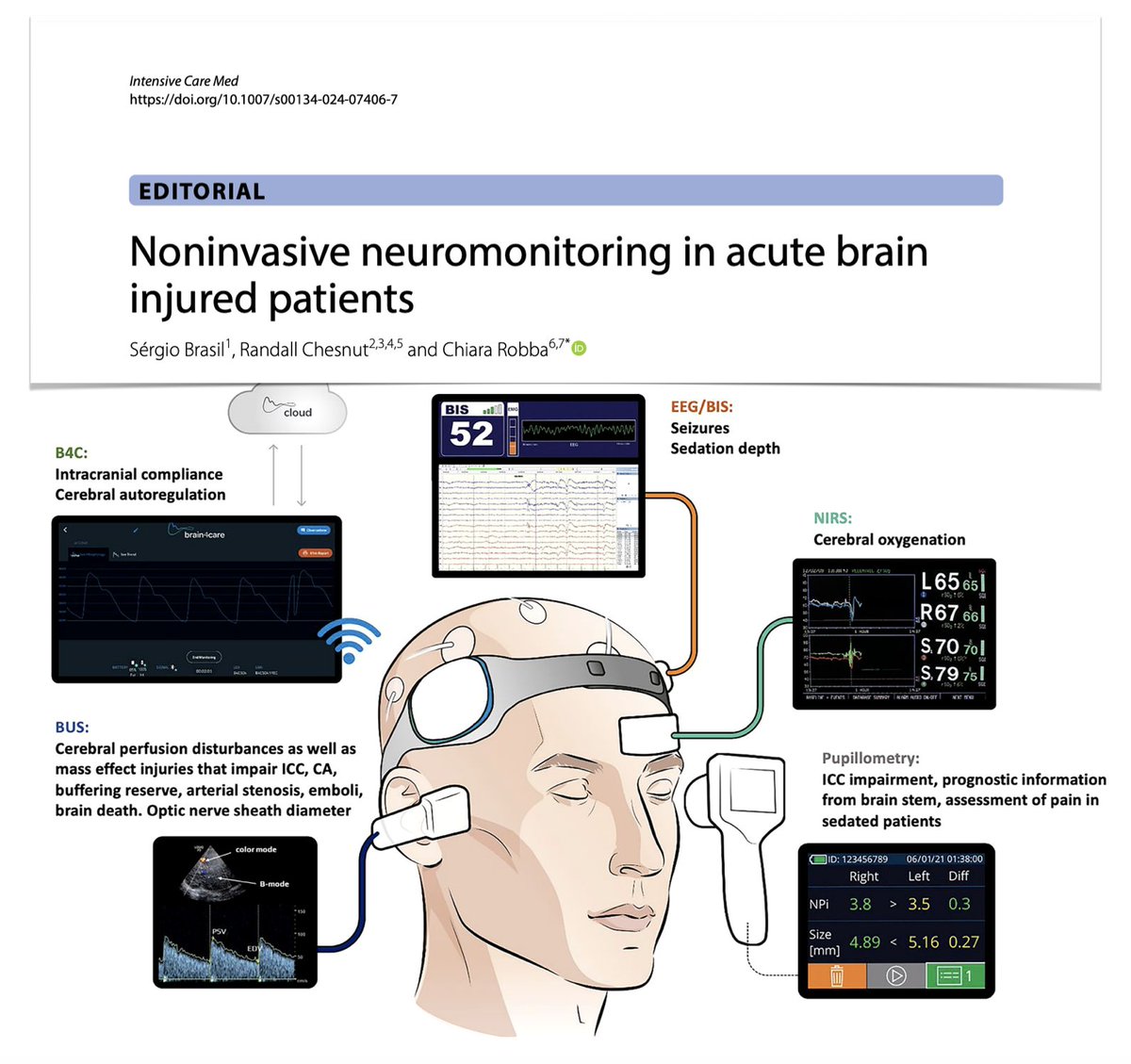 Noninvasive neuromonitoring in acute brain injuries to help evaluating cerebral 🩸hemodynamics ⚡️electrical activity 🧠function ⚙️mechanical properties 💨oxygenation Use should be included in multimodal approach including neuroimaging/clinical factors. 🔓rdcu.be/dE4rp