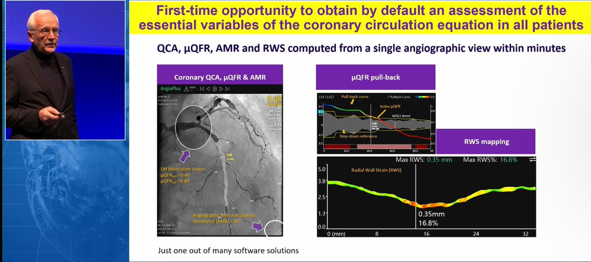 monaltiren's tweet image. #CoronaryPhysiology
#PCIoptimization

Prof William Wijns
ipcimeeting.com/2024

RATES of

😮 PCI OVER-TREATMENT
without FFR/QFR

😳 Physiologically suboptimal
FFR or QFR AFTER PCI

😩 Recurrent angina after PCI

✅ ANGIO-based physiology: 
to optimize revascularization

👇