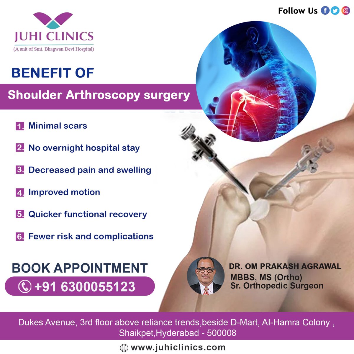 'Discover #painrelief & #mobility restoration with #ShoulderArthroscopy. Minimally invasive. Faster recovery. Improved function. Consult today for relief!'

#juhi #juhiclinics #dromprakashagrawal #orthopedic #orthopedicdoctor #orthopedicdoctorinhyderabad #orthopedicsurgeon