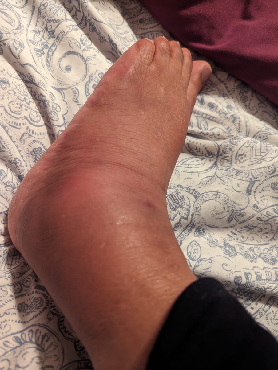 AnuTHEfernandez's tweet photo. Disappointed, @Etihad Airways! Mom with severe leg pain flying NYC via Abu Dhabi. 2.5hr delay in Bengaluru & NO wheelchair provided in Abu Dhabi! Forced her to walk long distances for immigration& connection. Passengers deserve better! #ImproveAccessibility #WheelchairAssistance https://t.co/KVD7pVKn4K