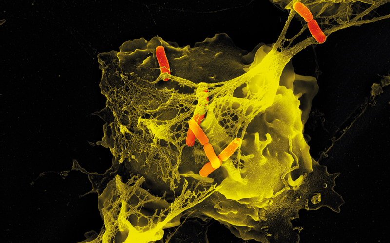 Stress hormones can trigger the formation of structures that make body tissues more susceptible to metastasis, research has found. thebiomedicalscientist.net/news/cancer-an…