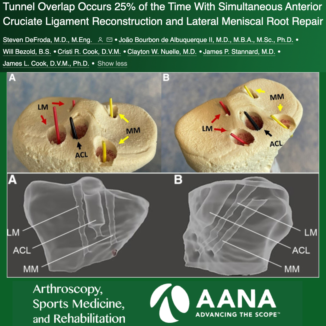 This study demonstrated 25.9% rate of overlap for combined LMPR repair and ACLR, compared with 0% for MMPR repair with ACLR. @NuelleSportsMD @SDeFrodaMD

ow.ly/ZbJX50RbRKz