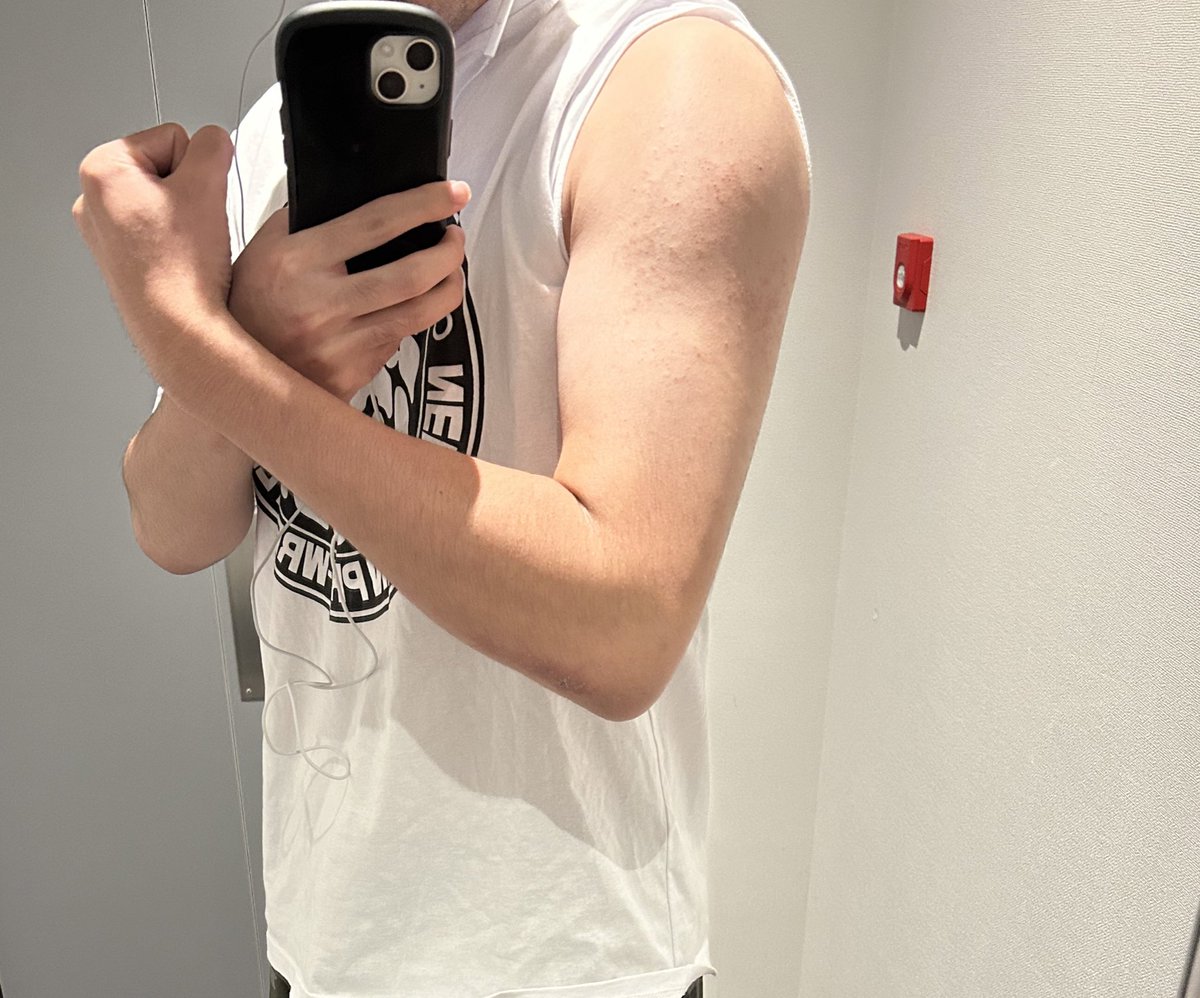 JTO_pw's tweet photo. ここ2日間膝に違和感があったので
あまり負荷がかからないように
今日は腕トレを中心に行いました‼️
膝はレスラ���にとって大事なので入念に
マッサージ👍
#JTO練習生への道 https://t.co/nXjMoGR2wy