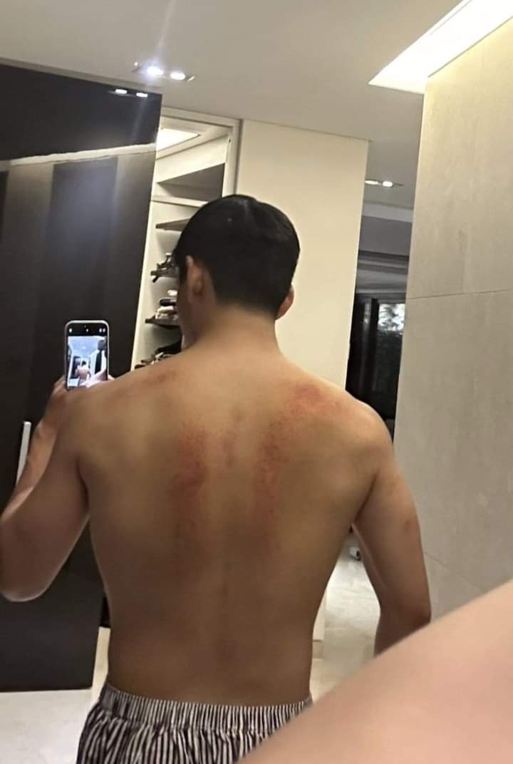 JunggukKoo's tweet photo. Time heals                                  But scars
all wounds                                    remain...

#BTS #TAEHYUNG https://t.co/CYCx8cJnYw