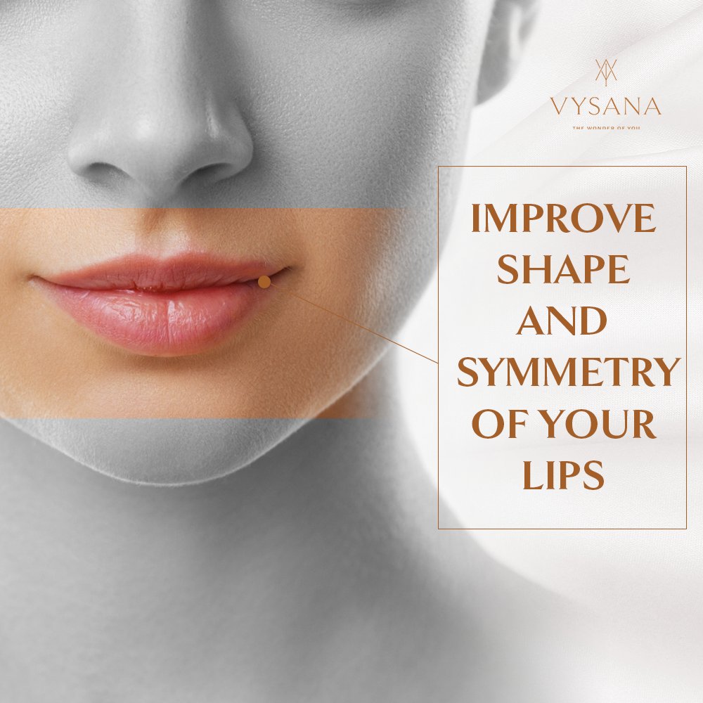 Beautiful, fuller, younger lips are only a consultation away ⤵️
vysana.com/dermal-fillers… 

Lip enhancement can have a huge positive impact on how you feel and look.

Book Now!

#lipfillers #lips #fillers #dermalfillers #lipinjections #beauty #aesthetics #lipfiller