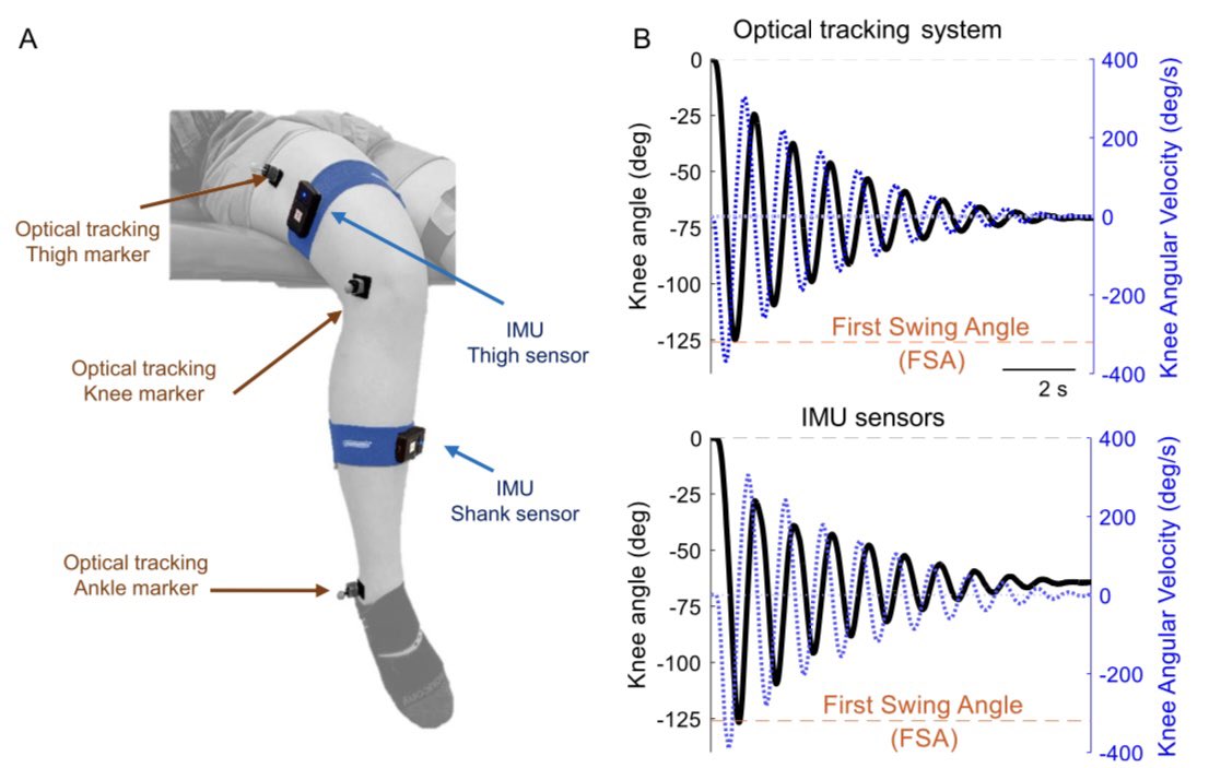 Congratulations to Dr Dalia De Santis from @AbilityLab and @NUPTHMS she developed an easy to use, reliable, and inexpensive system to assess symptoms of spasticity in our patients! 
link.springer.com/article/10.118…