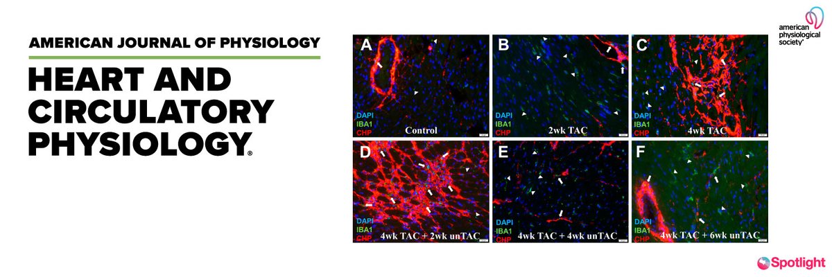 Spotlight Cover

Role of Macrophages in Regression of Myocardial Fibrosis Following Alleviation of Left Ventricular Pressure Overload
Neff et al. <a href="/medunivsc/">Medical University of South Carolina (MUSC)</a> 
ow.ly/AFGG50Riz4H

#Macrophages  #Fibrosis  #HeartFailure