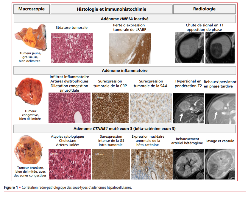 Hépato-Gastro&Oncologie Digestive (@hepato_gastro) / Posts / X