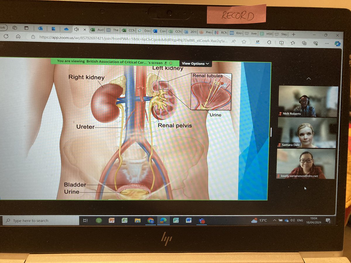 RebeccaS π (@itubecks) on Twitter photo Who is joining me at BACCN Midlands Renal Study event tonight? It looks like a really educational evening <a href="/BACCNUK/">BACCN π</a> <a href="/KatieJayneBurns/">Katie Burns (She/Her)</a> <a href="/lovelyann0320/">Lovely Ann Sorianosos π΅ππ¬π§π</a> <a href="/SamaraM_RN/">SamaraM</a> #BACCNRenalRecap Who is joining me at BACCN Midlands Renal Study event tonight? It looks like a really educational evening <a href="/BACCNUK/">BACCN π</a> <a href="/KatieJayneBurns/">Katie Burns (She/Her)</a> <a href="/lovelyann0320/">Lovely Ann Sorianosos π΅ππ¬π§π</a> <a href="/SamaraM_RN/">SamaraM</a> #BACCNRenalRecap