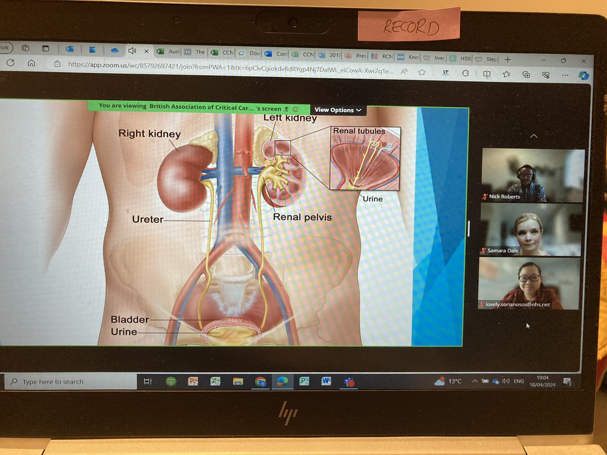 Who is joining me at BACCN Midlands Renal Study event tonight? It looks like a really educational evening @BACCNUK @KatieJayneBurns @lovelyann0320 @SamaraM_RN #BACCNRenalRecap