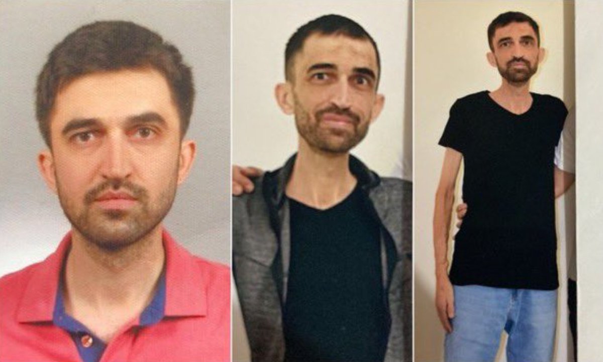 KHK detaineeMehmetParlak,who has been living with a single kidney for10y, has been in prison since2022for reasons not considered a crime under the law.Due to delays in receiving necessary treatments in prison,his single kidney has lost 70% of its function.
#HumanRights
@notorture