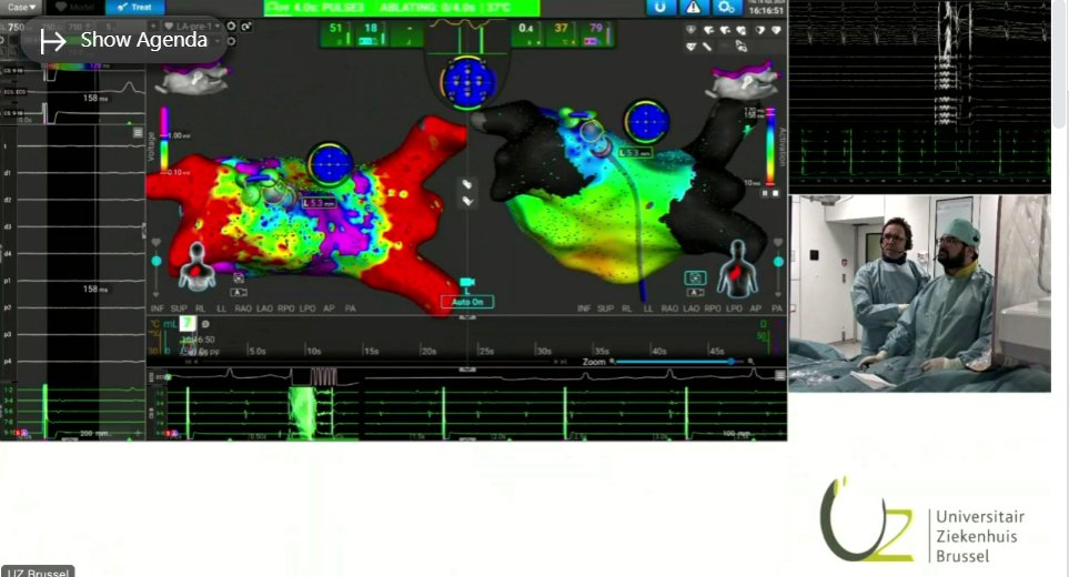 Electroporation (AFERA) #EPLiveAustin24 Speakers: @dogi84md, Dr. Gian-Battista @Deuhealthtrsm