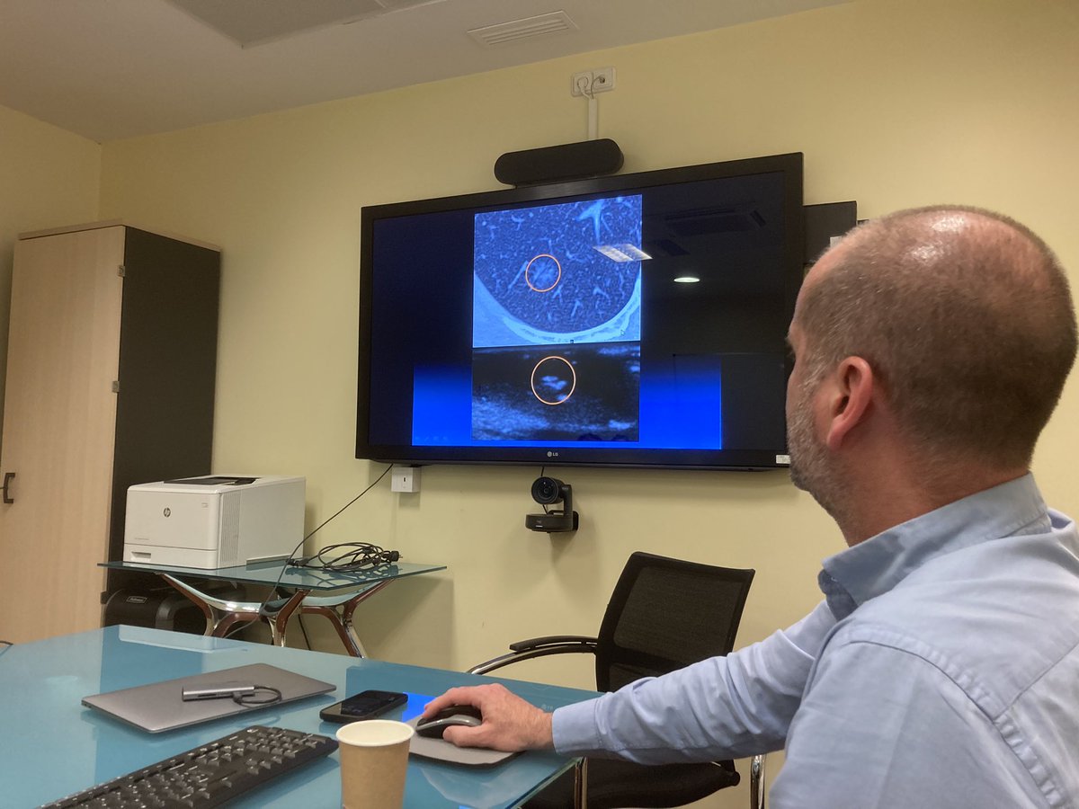 Intraoperative and postoperative lung ultrasound for surgeons. An excellent presentation by @Ivanvollmert at @ThorSurgHClinic.

#thursdaysessions