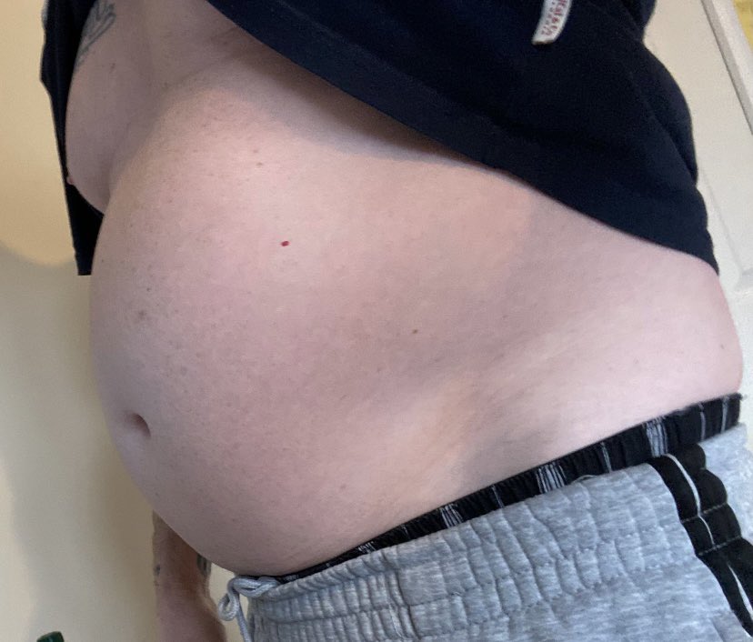 TheSilverLion1's tweet image. Shaping  up now.  My beer belly is about gone.  Hard work pays off.   Single no beer 🍻 or drugs.   Change diet. sun-beds lol 😜 And train hard.   #gymaddict #gymshark #FitnessGoals #goals #gymLife