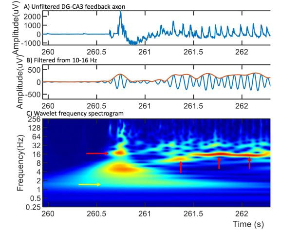 UC Irvine biomedical engineering researchers have uncovered a previously unknown source of two key brain waves crucial for deep sleep: slow waves and sleep spindles. Learn more at tinyurl.com/9myp8stj #biomedicalengineering #sleep #UCIEngineering