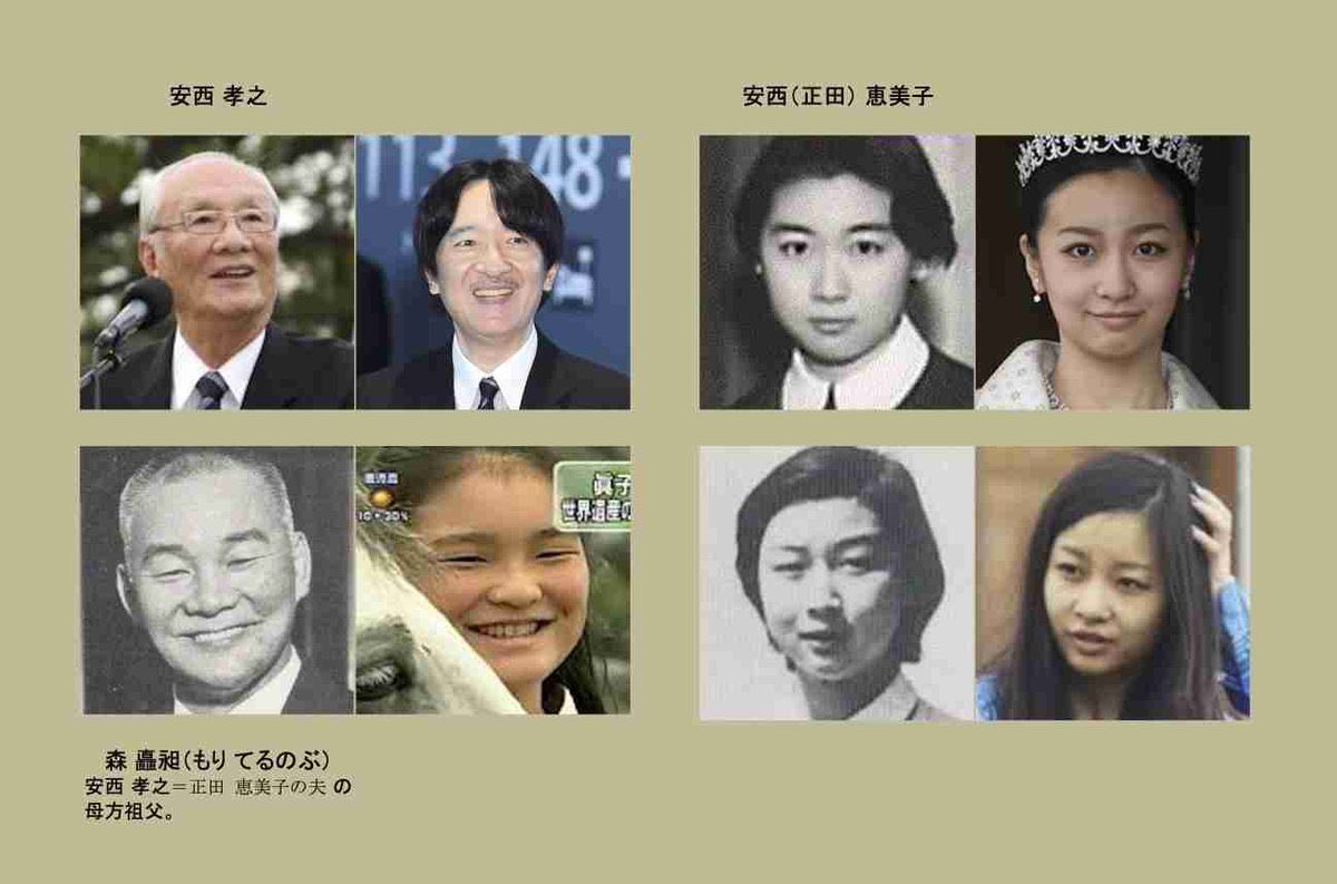 YNH83UubNDceUvO's tweet photo. 赤の他人にここまでそっくりなのを証明する理由でDNA鑑定を希望してます。
#秋篠宮にDNA鑑定を https://t.co/8Mx2aUu49r
