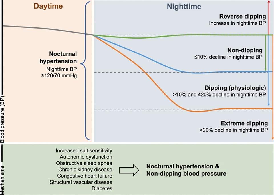 🔴 Non-Dipping Blood Pressure or Nocturnal Hypertension: Does One Matter More? #openaccess #2023Review 
 
link.springer.com/article/10.100…
#CardioEd #Cardiology #FOAMed #meded #MedEd #Cardiology #CardioTwitter #cardiotwitter #cardiotwiteros #CardioEd #MedTwitter #MedX #cardiovascular