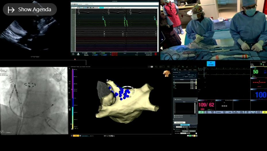 Electroporation (NAVX) #EPLiveAustin24 Speaker: @aalahmadmd