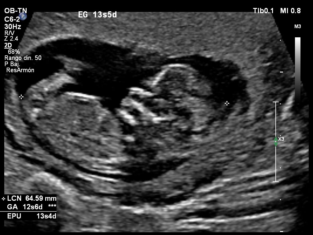 Muy enamorada me tiene😍
<a href="/velis_agos1236/">Agos Velis</a>