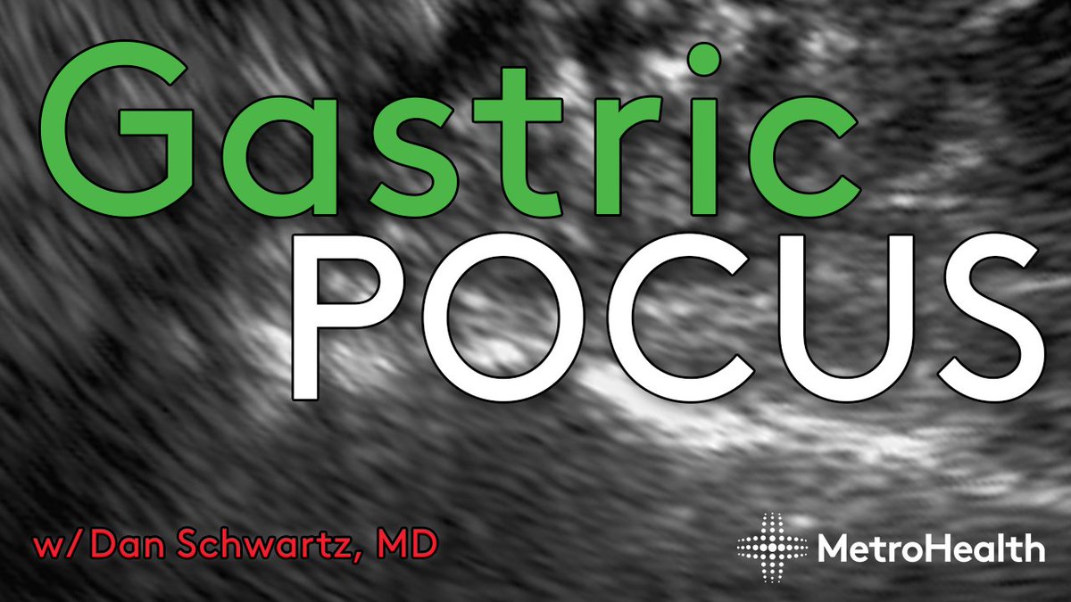 Check out our latest video about gastric POCUS in airway management by Dr. Schwartz and Dr. Leeds.

youtu.be/EvmjKsy5-ec

#POCUS #Ultrasound #airway #emergencymedicine #criticalcare #anesthesiology