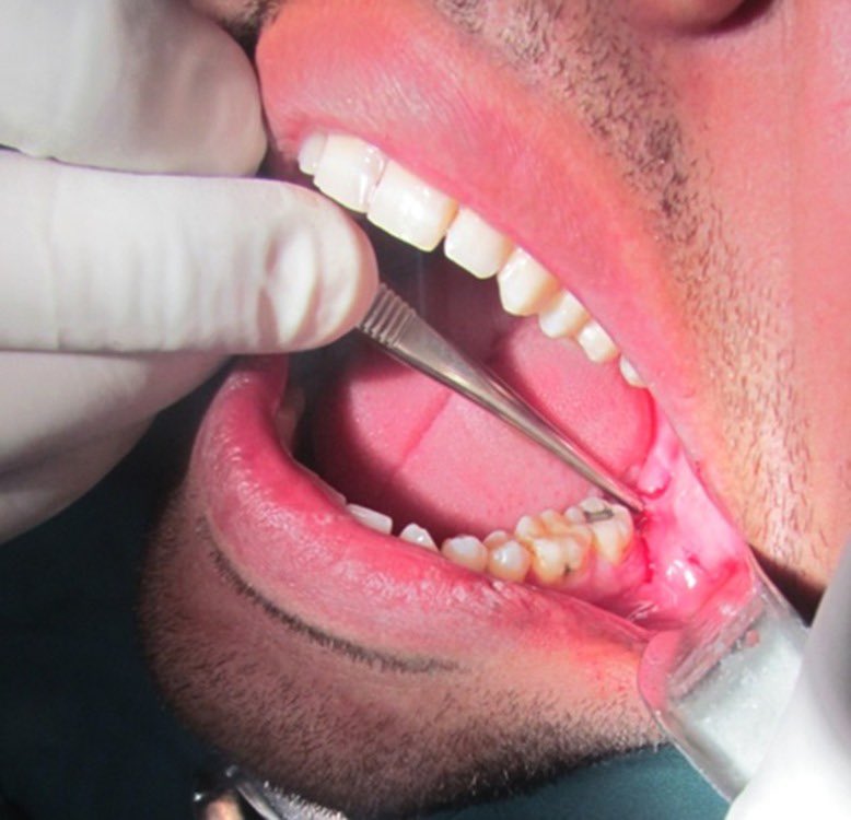 Abdulhamid tweet media