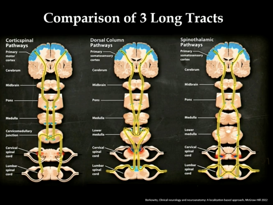 Clear and concise schematic of the 3 long tracts, the 'spine' of neuroanatomy. Thank you @AaronLBerkowitz for a wonderful review at #AANAM #MedTwitter #MedEd #EndNeurophobia #Neurotwitter