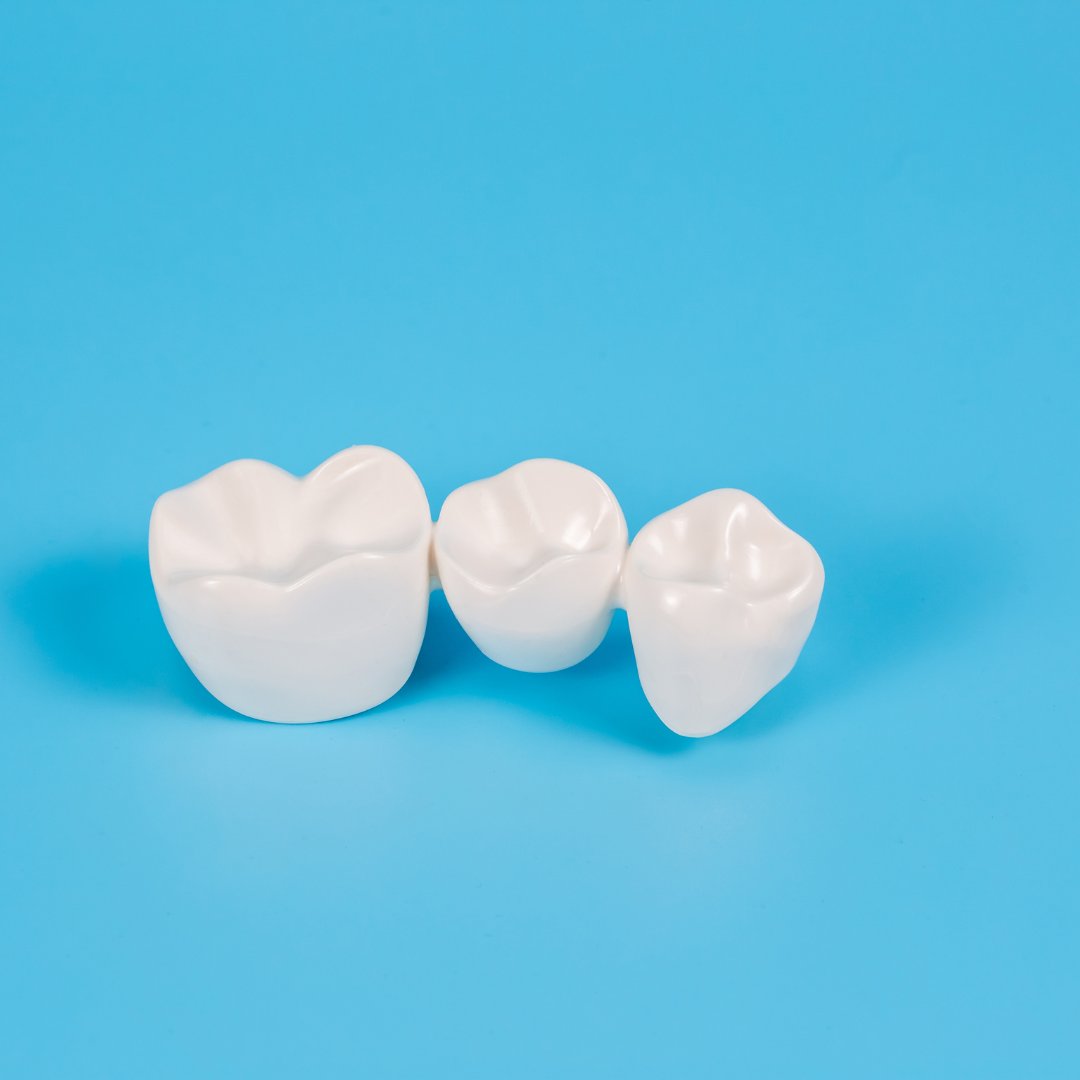 Dental Bridges and Oral Health

Learn more: 1l.ink/Z6P45LN 

#CornerstoneDentalPLLC #Dentist #EmergencyDentist #FamilyDentist #CosmeticDentist #PediatricDentist #TeethWhitening #DentalCleaning #Invisalign #Dentures #DentalClinic